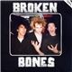 Broken Bones - Seeing Through My Eyes